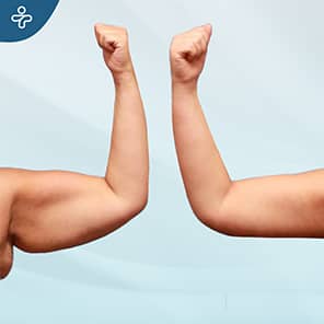 Arm Lift Patient Before After