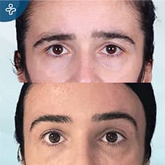 Before After