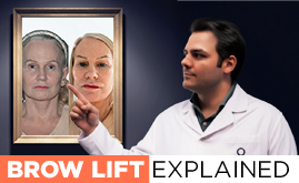 Un médecin explique l'opération de lifting des sourcils avec un exemple à l'écran.