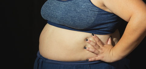 Close-up of a persons abdomen, illustrating the area targeted by mini gastric bypass weight loss surgery