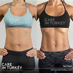 Sixpack-Operation Patient Vorher Nachher