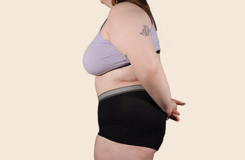 Overweight female patient in profile view before bariatric surgery, showing pre-op body weight