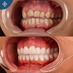 Before After Dentistry