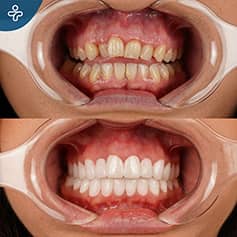 Before After Dentistry