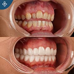 Before After Dentistry