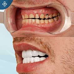 Before After Dentistry