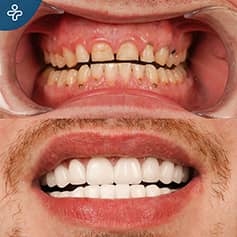 Before After Dentistry