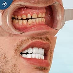 Before After Dentistry
