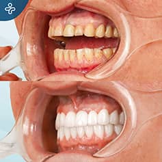 Before After Dentistry