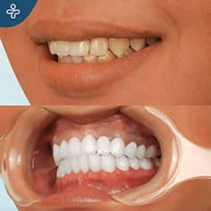 Before After Dentistry