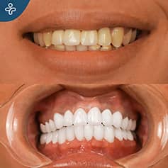 Before After Dentistry