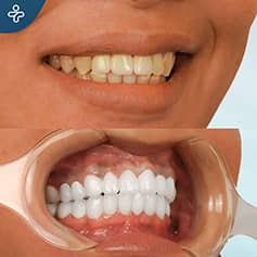 Before After Dentistry