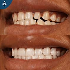 Before After Dentistry