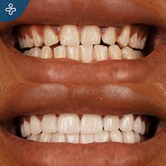 Before After Dentistry