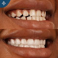 Before After Dentistry