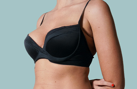 Woman with arms raised showing breasts before cosmetic breast surgery evaluation