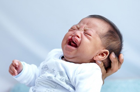 Infant crying during medical examination related to cleft lip and cleft palate congenital condition