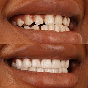 Paciente dental antes y después