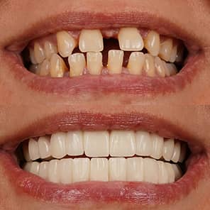 Paciente dental antes y después