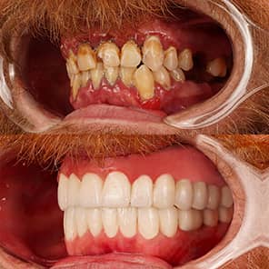 Patient dentaire avant après