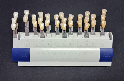 VITA Toothguide 3D-MASTER used for selecting tooth shades in cosmetic dental treatments