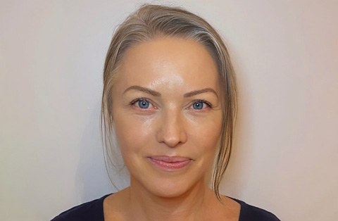 Woman with smooth facial contours and refreshed appearance representing natural facelift results in Turkey.