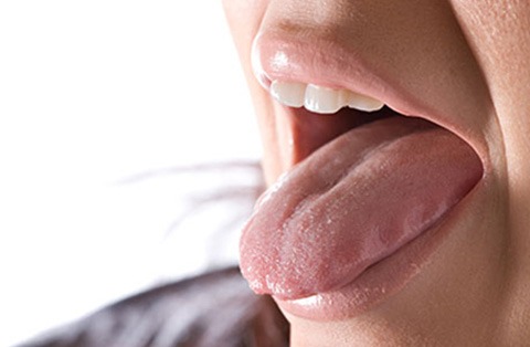 Close-up of patient tongue during oral examination related to glossectomy surgical procedure