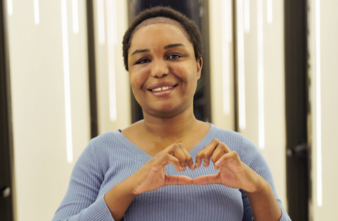  An Afro-textured hair woman smiles, making a heart shape with her hands, after a hair transplant for women