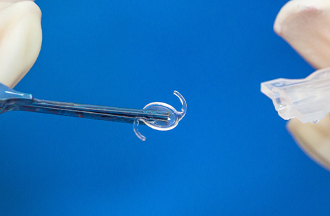 Close-up of surgeon holding an intraocular lens for implantation during cataract surgery in Turkey