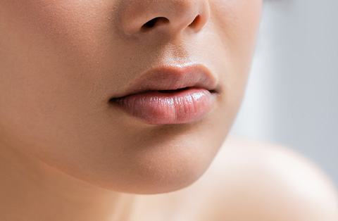 Close-up of upper lip and nose area after lip lift surgery in Turkey enhancing lip shape and balance