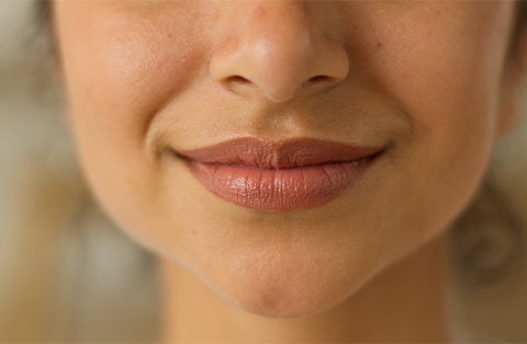 Close-up of a woman’s lips after successful lip reconstruction surgery in Turkey