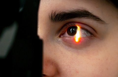 Close-up of eye during retina scan in Turkey, showing evaluation before advanced retina transplant procedure