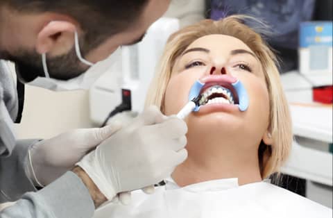 Dentist applying bleaching gel to patient’s teeth with cheek retractor during professional in-office teeth-whitening treatment