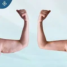 Braquioplastia antes y después