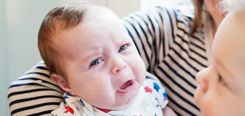 Infant with uneven mouth movement while crying—classic sign of asymmetric crying face syndrome.