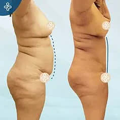 Before After