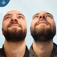 Before After