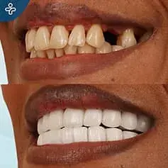 Hollywood sorriso compiuto