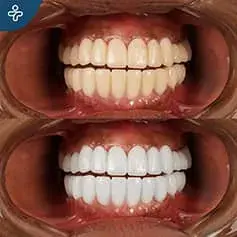 Transformación Dental Deslumbrante