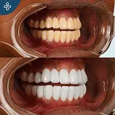 Transformación Dental Deslumbrante