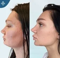 L'Objectif