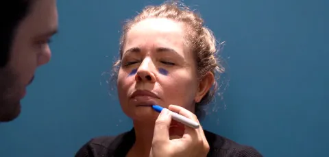 Surgeon marking woman’s face with pen before mini facelift cosmetic procedure