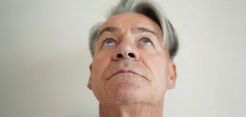 Male patient looking up during pre-op examination for septorhinoplasty procedure